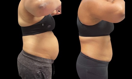 60 minute Laser Lipo Session - Southern Shapez