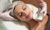 Up to 66% Off on Facelift - Non-Surgical at Santorini Spa Llc