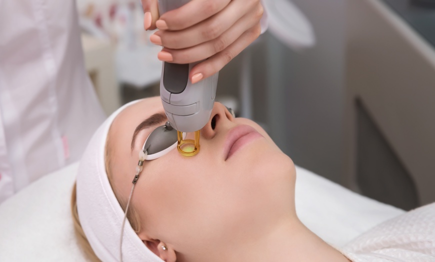 Image 7: Laser Skin Resurfacing Treatment at Rewind Medical Spa by Sharicom Health(Up to 30% Off)