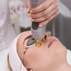 Image 7: Laser Skin Resurfacing Treatment at Rewind Medical Spa by Sharicom Health(Up to 30% Off)