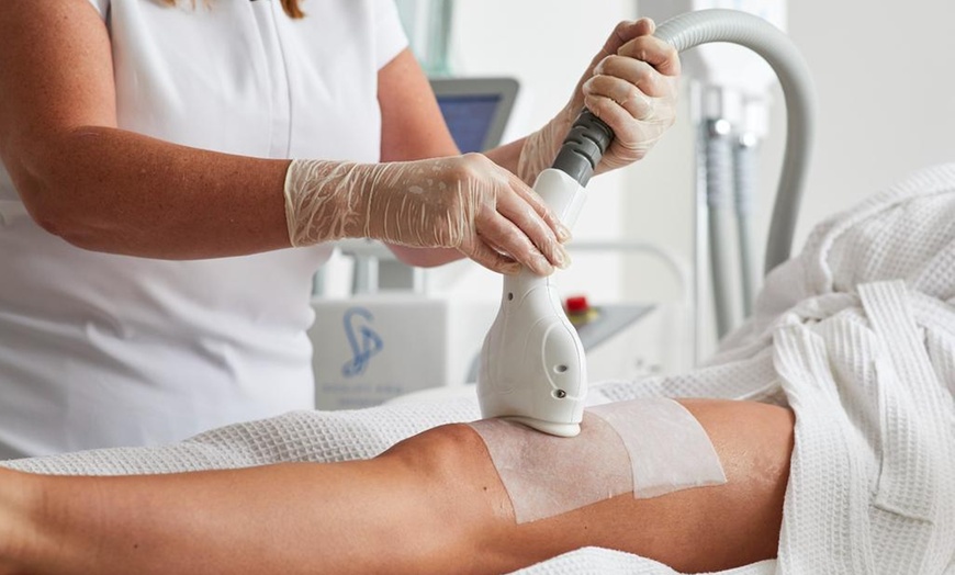 Image 4: Up to 45% Off Fat Freezing (Cryolipolysis) 