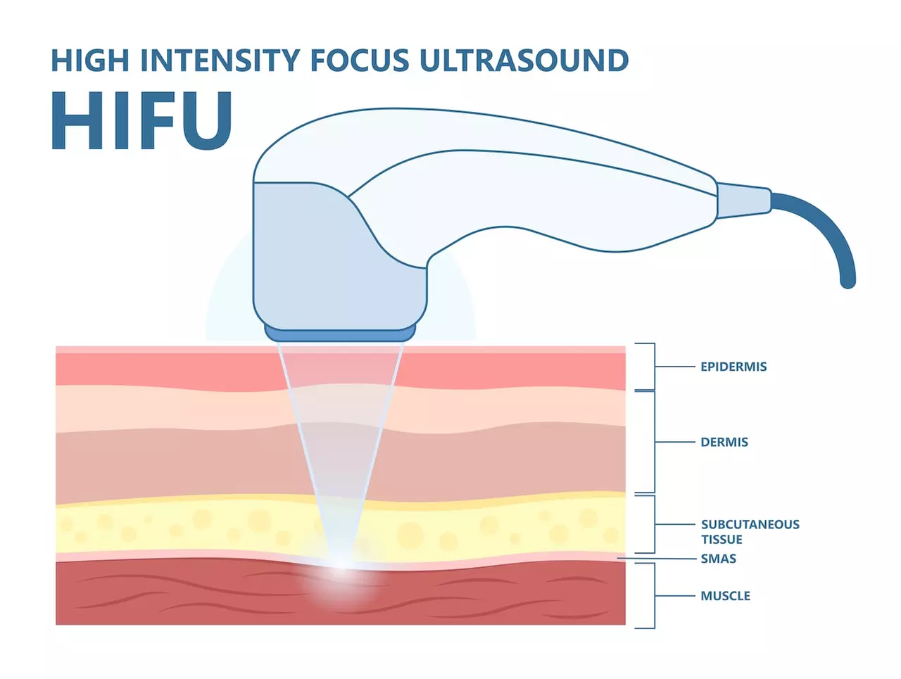 Up to 34% Off on HIFU Ultrasound Face Tightening at A Beauty By Design