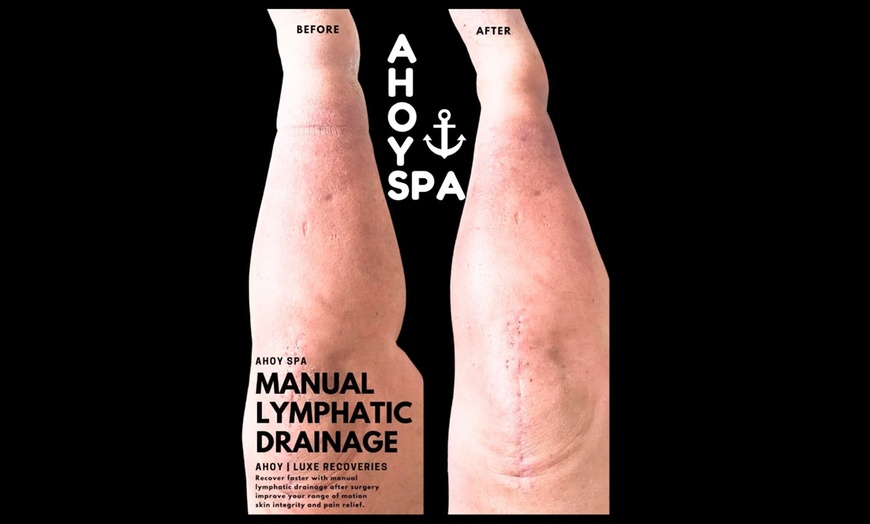 Image 4: Experience Relaxation with Post-Op and Zero Gravity Massages