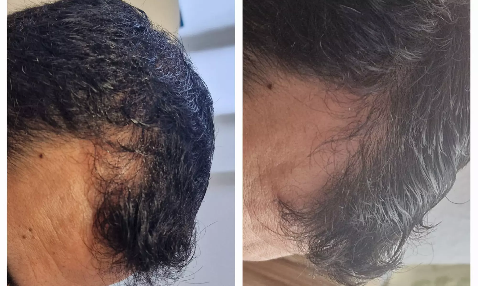 Bis zu 30% Rabatt auf den Injektionsbehandlung – Plasma bei PRIVATPRAXIS Nataliya Katsarova