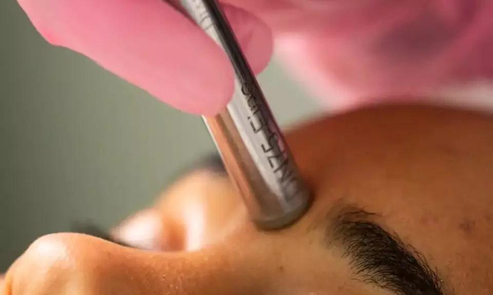 Up to 35% Off on Facial - Chosen by Customer at Skinful Aesthetics - Primary Image