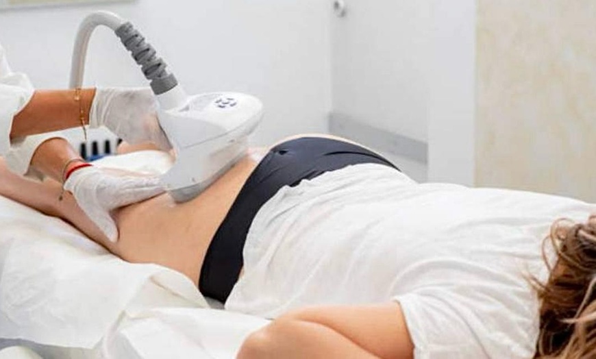 Image 2: 1 o 3 sesiones de tratamiento remodelador con radiofrecuencia, vacumterapia e infrarrojos para 1 persona