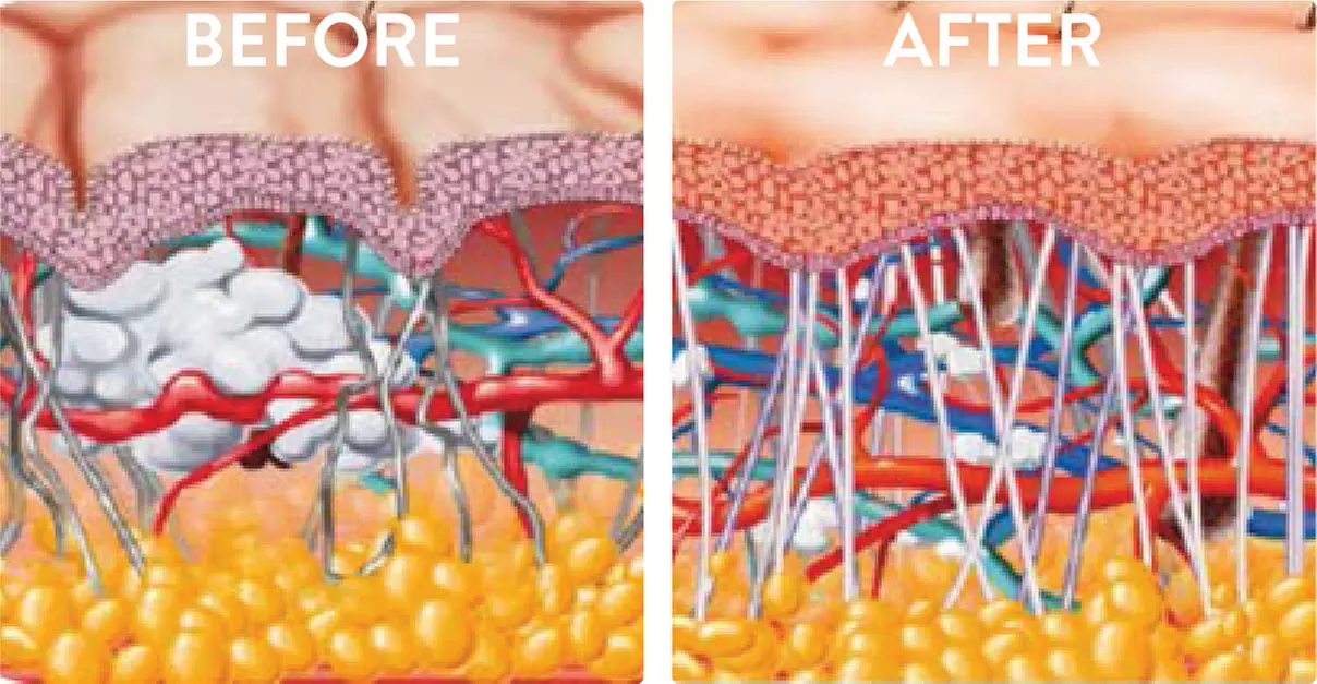 Revitalize Your Look with Cryo Face & Body Session