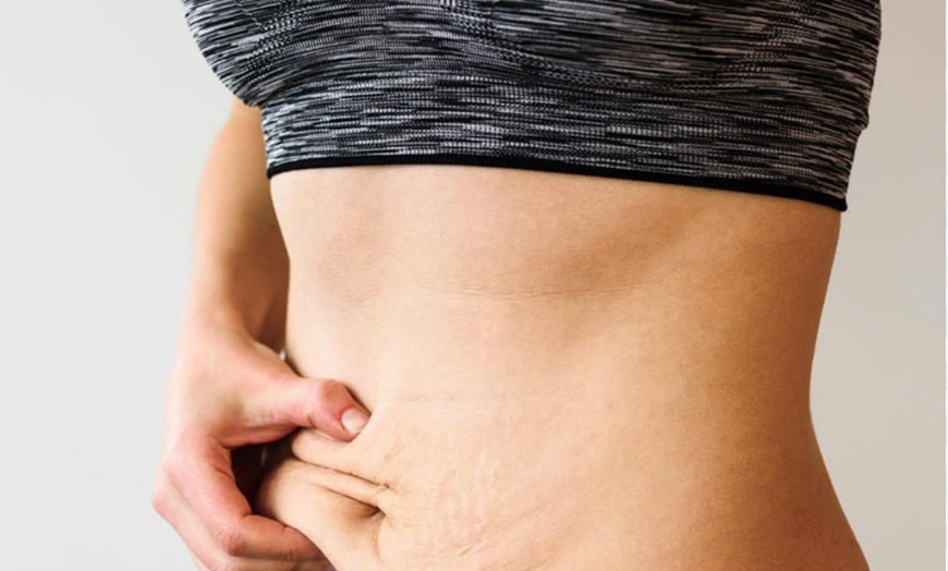 Image 1: Up to 71% Off on Spa / Salon Beauty Treatments at Beautiful skin by Angela