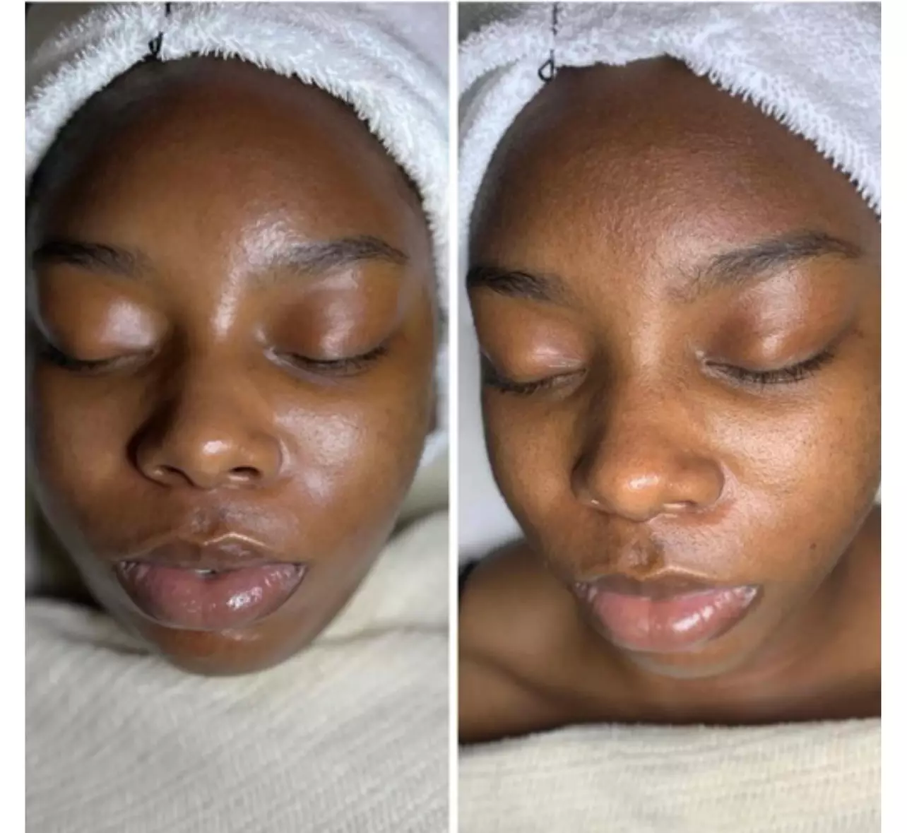 Up to 45% Off on Anti-Aging Facial at Luxxury Skin LLC - Primary Image