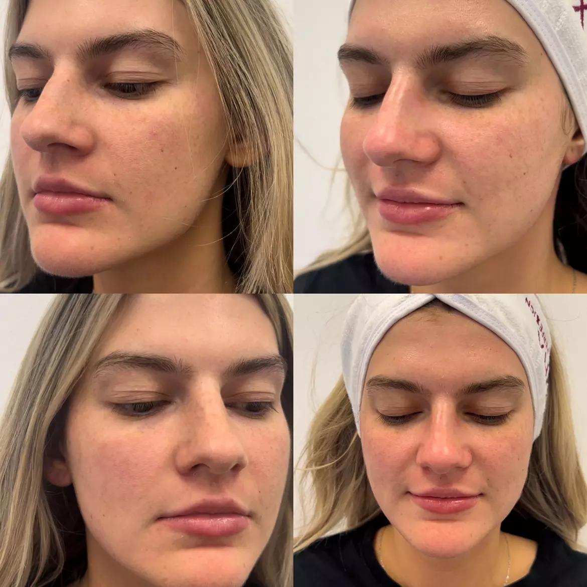 Up to 60% Off on Anti-Aging Facial at SAAESTHETICS