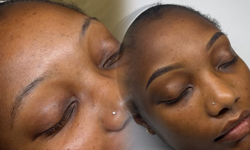 Image 5: Microshading Session with Optional Touch-Up