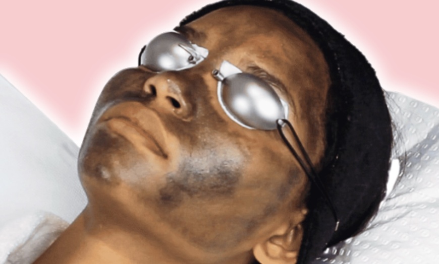 Image 2: Up to 55% Off on Laser Skin Resurfacing at Pynkberry Aesthetics