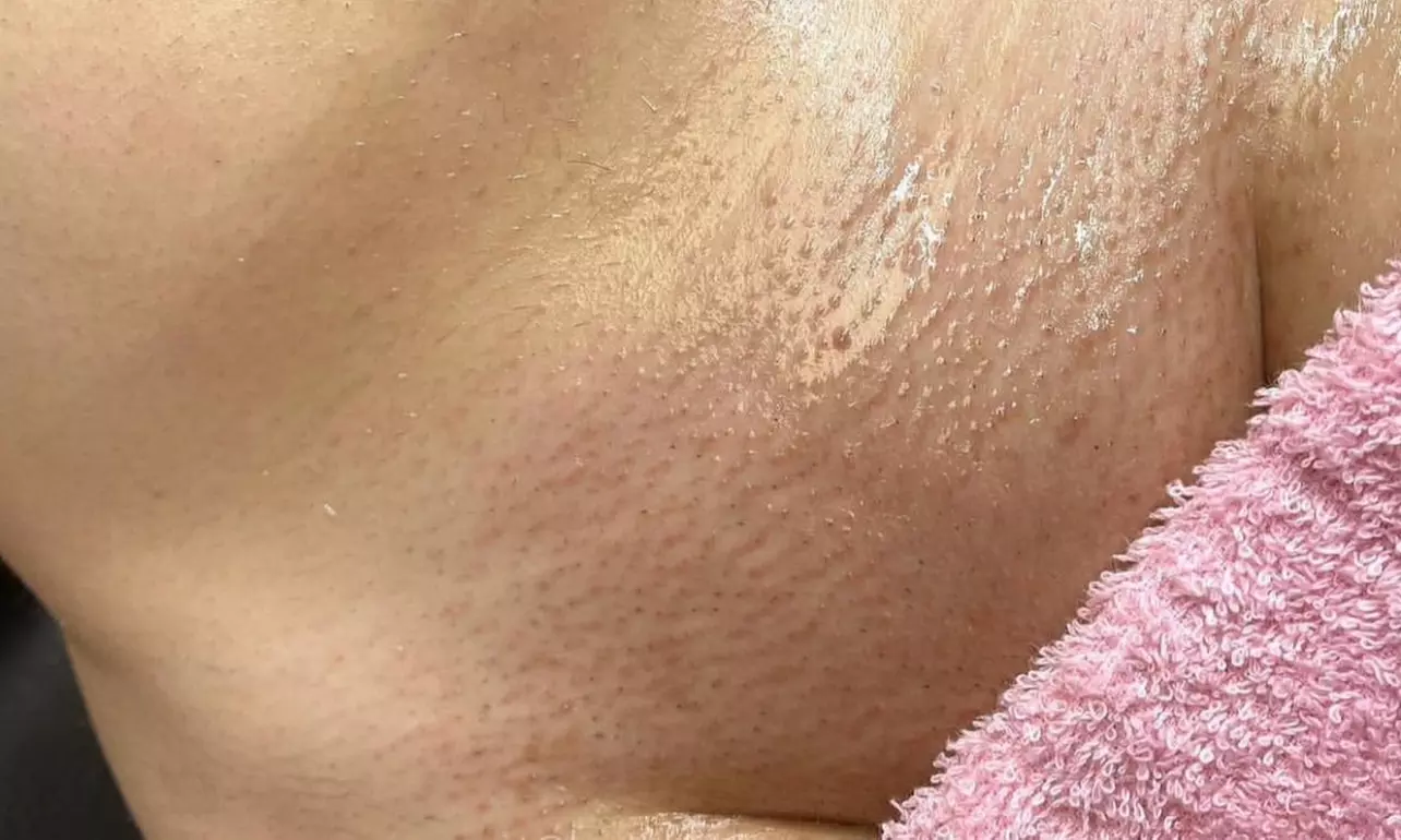 Enjoy a Refreshing Vajacial or Wax Combo for Smooth Skin