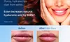 One or Two Sessions of Needle-less Lip Enhancements at Newport Vision and Wellness (Up to 55% Off)