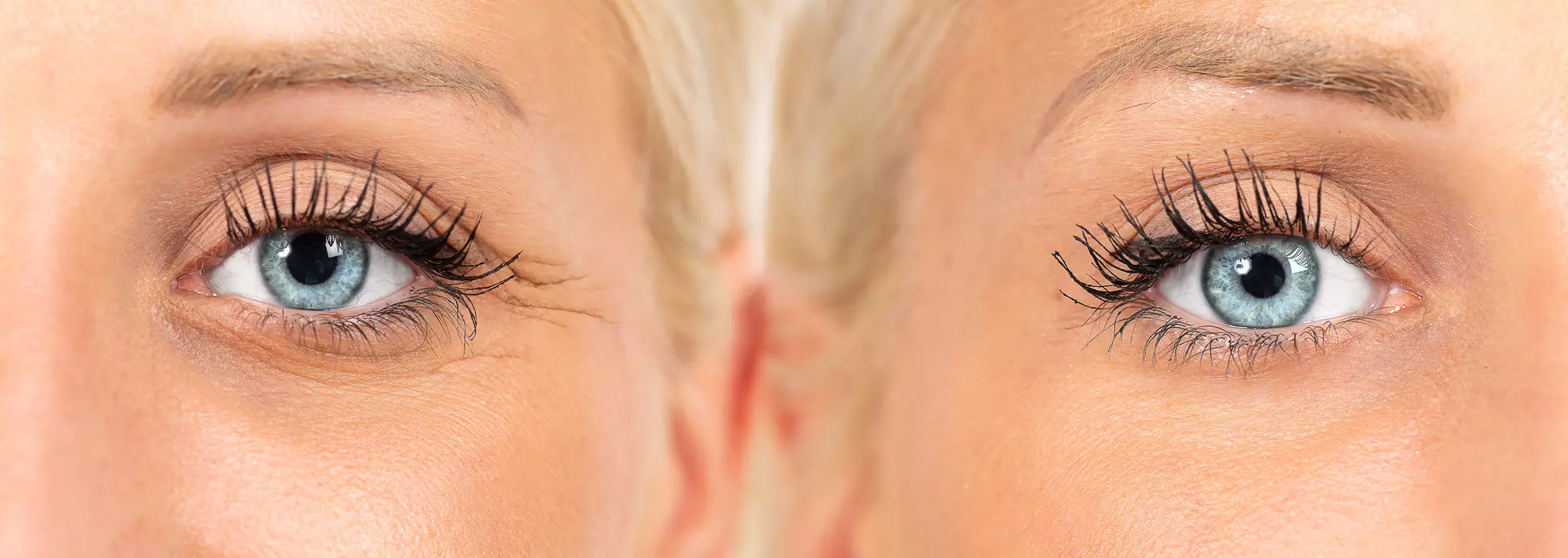 Up to 37% Off on Injection - Anti Wrinkle at Tomas Dental Clinic