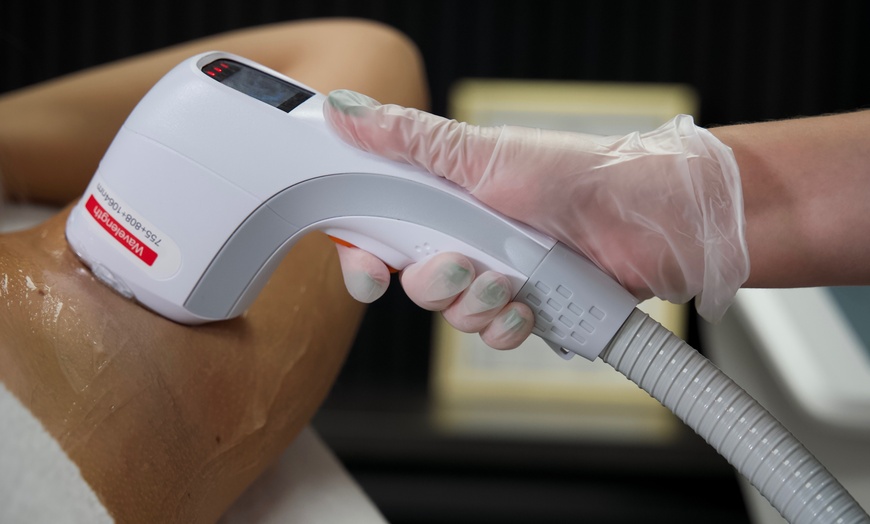 Image 2: Laser Hair-Removal Session: Your Path to Flawless Skin