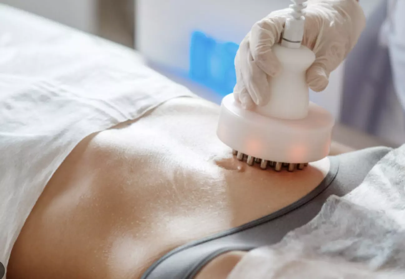 Up to 52% Off on Radio Frequency Skin Tightening at Nude by Priscilla - Second Medium