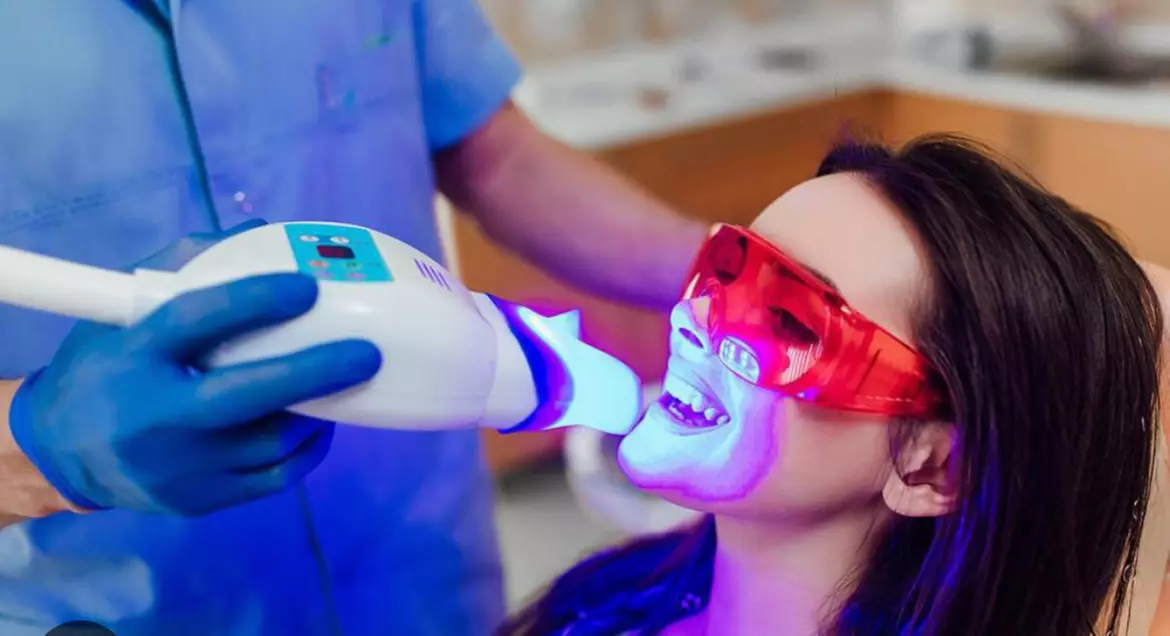 Brighten Your Smile with Tooth Gem or One Zoom Teeth Whitening Treatment at Divine Beauty Suite. Save Up to 60% - Primary Image