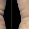 Image 4: Fat / Cellulite Reduction - Non-Branded at Dpz parlour