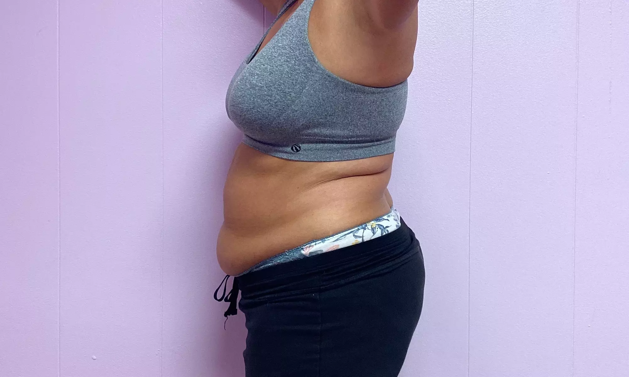 Up to 60% Off on Lipo - Non-Invasive Laser-iLipo at Pointer In My Direction Body Studio - Primary Image
