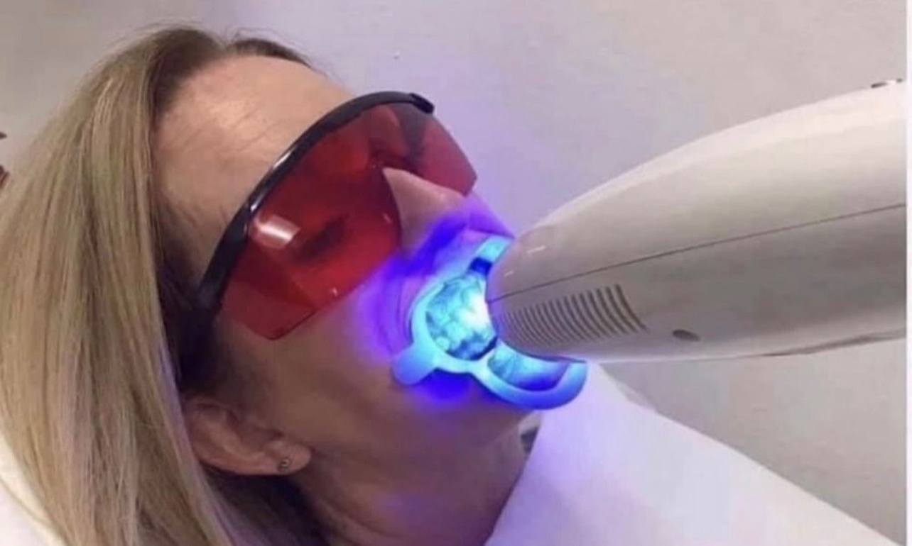 Up to 53% Off on Teeth Whitening - In-Office - Non-Branded at ADVANCED TEETH WHITENING BEAUTY STUDIO