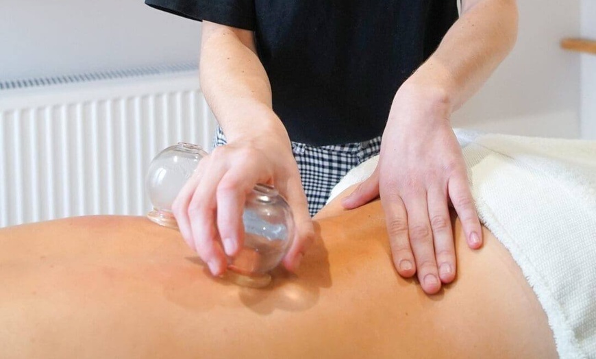 Image 2: Acupuncture Consultation + Treatment w/ Full-Body Red Light Therapy