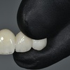 Image 6: Up to 91% Off on Dental Implant / Corona / Veneer at ImplantWIDE Skokie