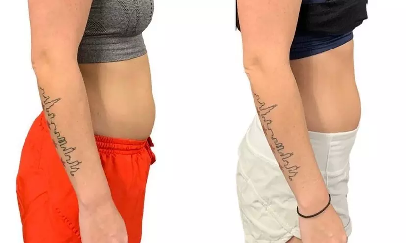 Up to 59% Off on Cryotherapy at Coldfront Cryo - Second Medium