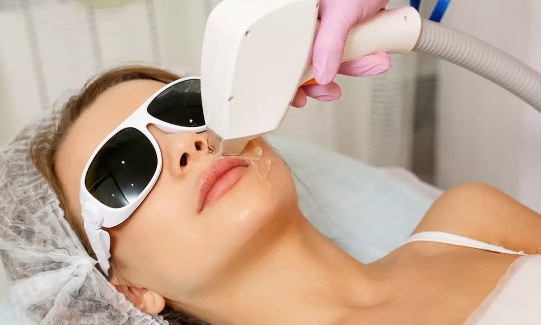 Up to 45% Off on Laser Hair Removal at Jash Beauty Bar