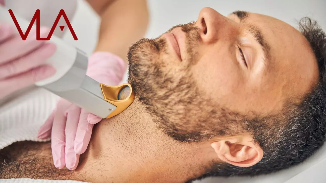 Experience up to 50% off with Skin Perfect Brothers for small and medium area laser hair removal sessions