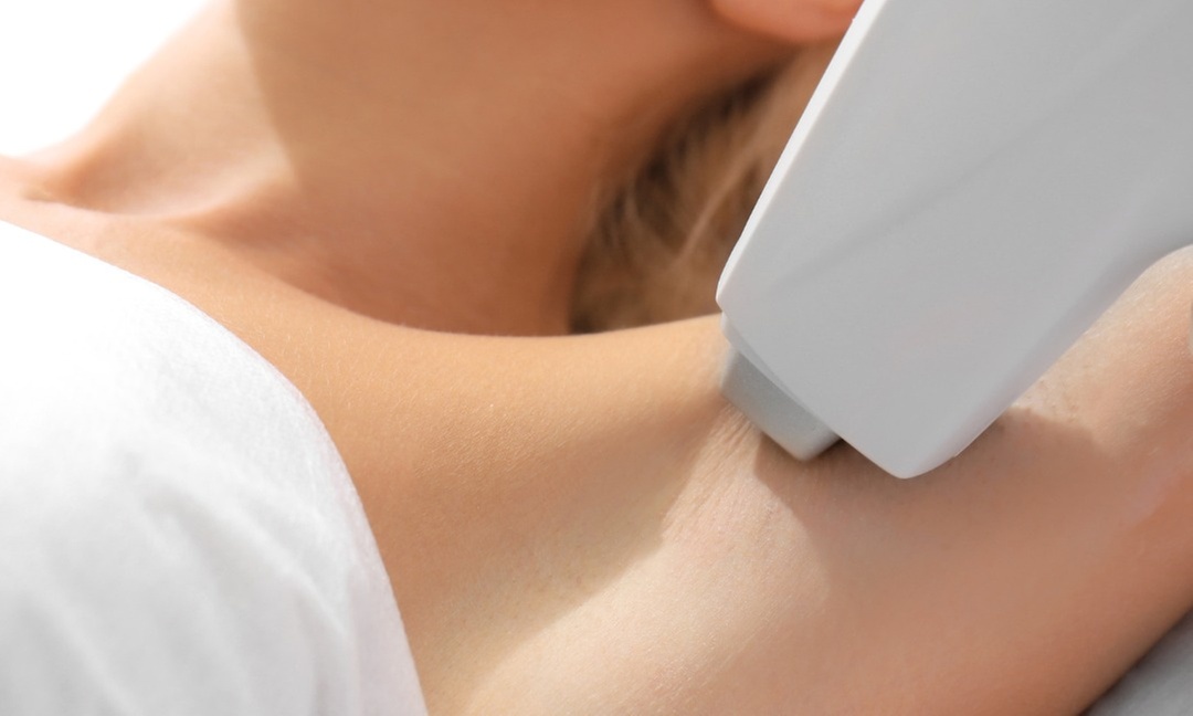 Up to 51% Off on Laser Hair Removal at Jash Beauty Bar