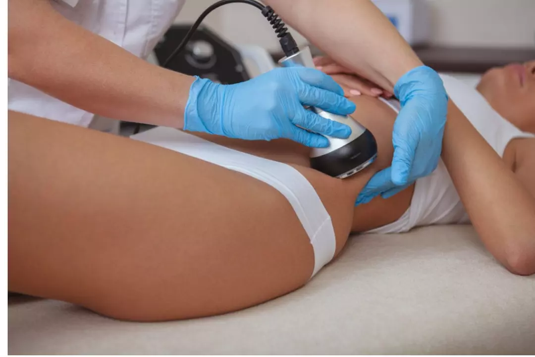 Up to 56% Off on Ultrasonic Fat Reduction at Body By Design Body Contouring Spa - Primary Image