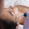 Image 6: Microneedling with Laser Resurfacing for the Hands, Lower Eyes, Neck, or Full Face at Loma Laser (Up to 47% Off)