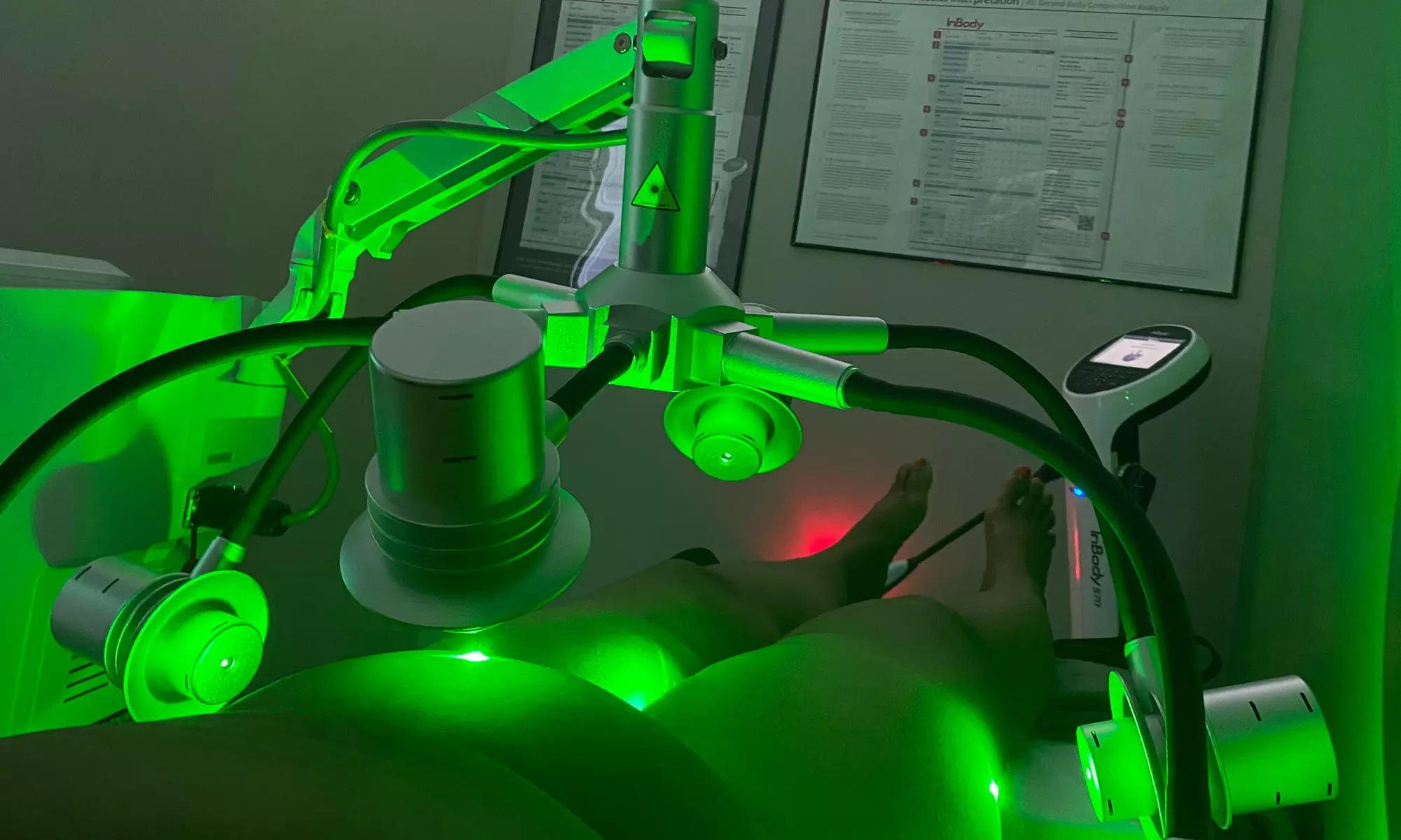 Experience Body Sculpt Better Body Bar's innovative laser lipo trial session with non-invasive technology, up to 40% off - Primary Image