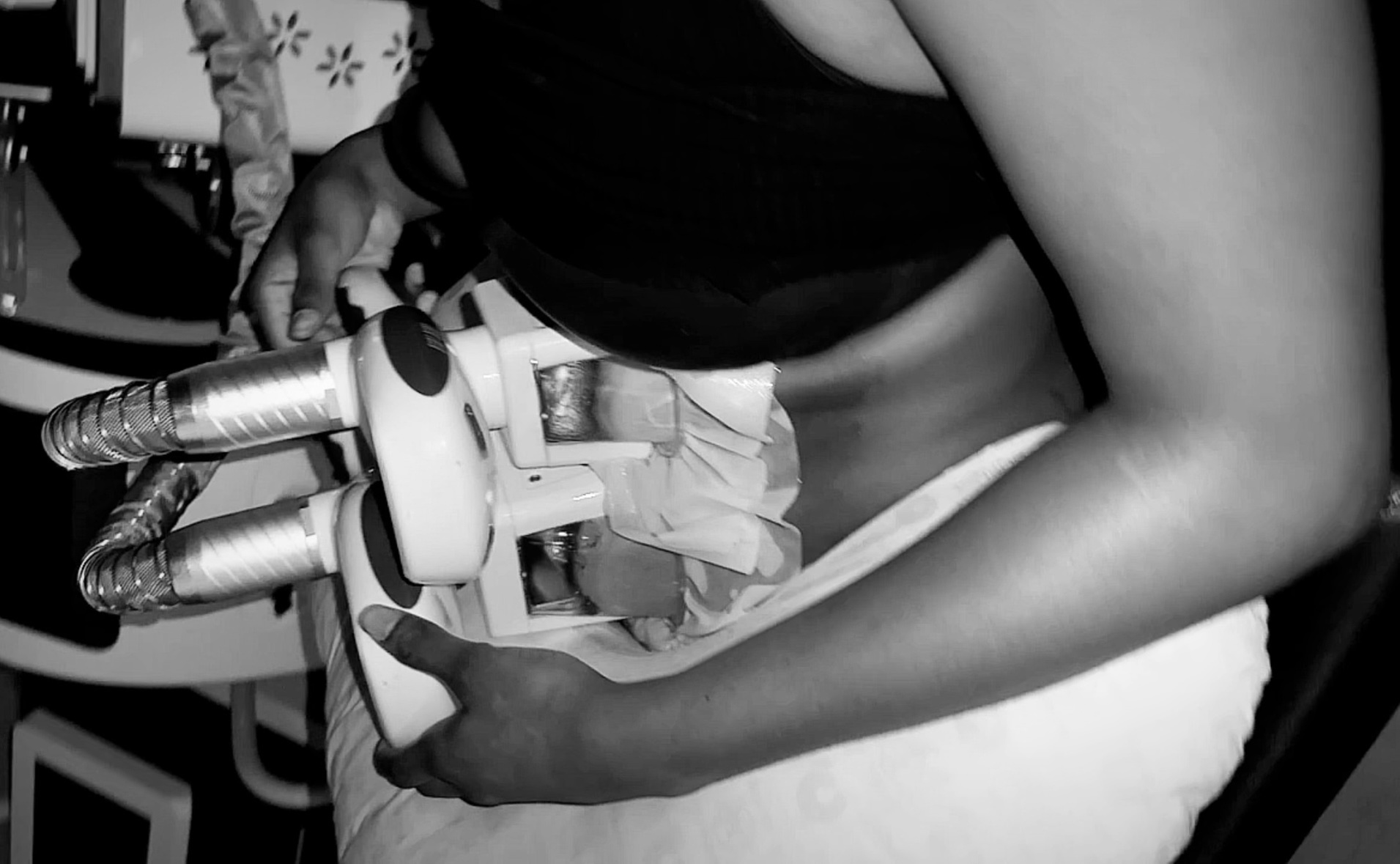 Effective Coolsculpting Treatments for Targeted Fat Reduction