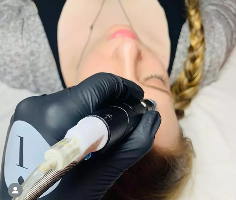 Up to 31% Off on HydraFacial at Hydrabeauty - Primary Image