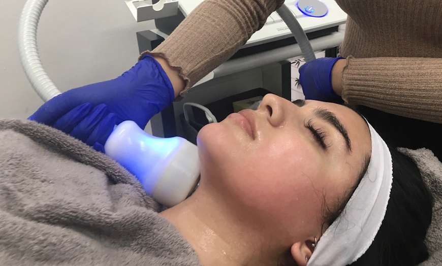 Image 1: Refresh Your Skin with Cryo Tschock Facials