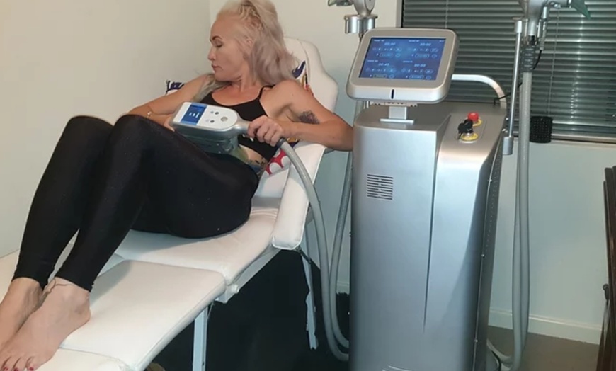 Image 1: Cryolipolysis Fat Freezing on Two Areas at Vibration Cafe