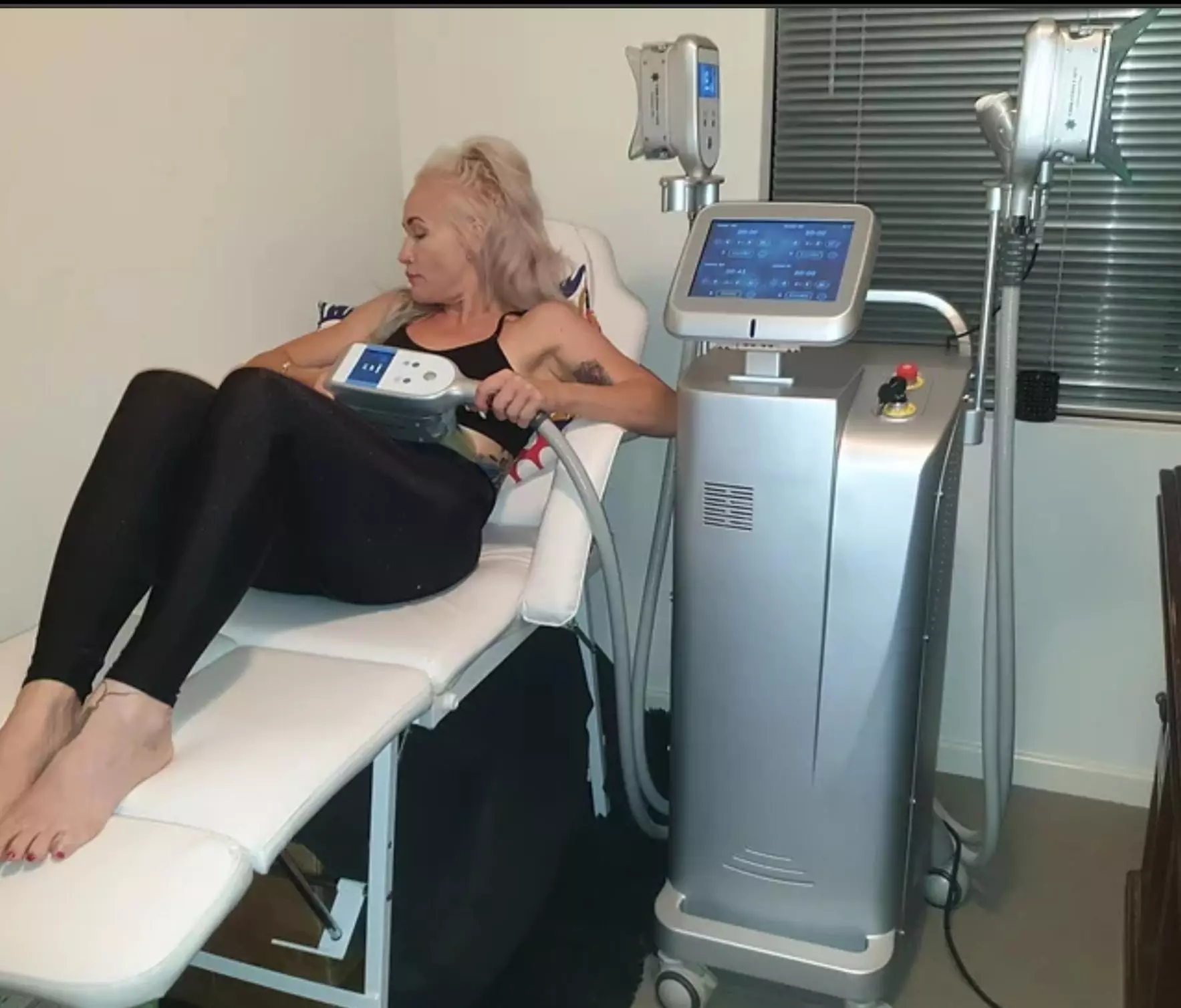 Cryolipolysis Fat Freezing on Two Areas at Vibration Cafe