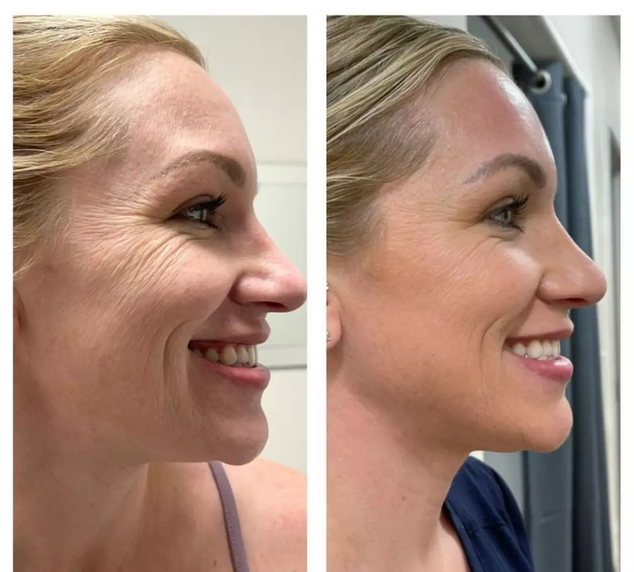 Up to 60% Off on Anti-Aging Facial at Chisel Skincare Studio - Primary Image