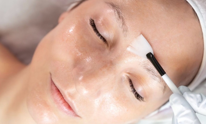 Image 1: Up to 35% Off on Chemical Peel at Revive Skin Studio