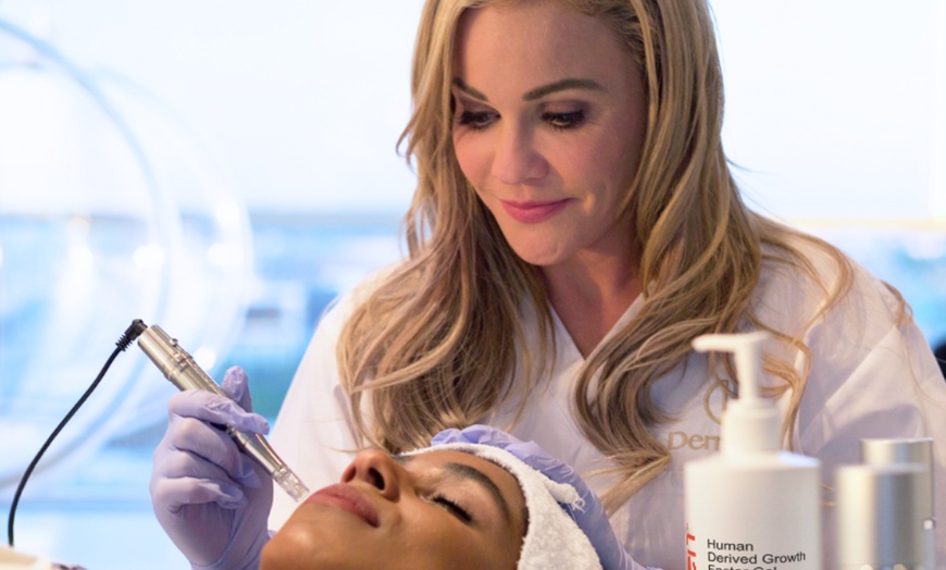 Image 2: Up to 34% Off on Micro-Needling at W&M Beauty Center