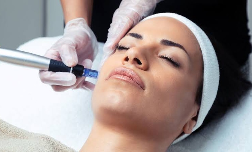 Image 1: Up to 61% Off on Micro-Needling at Melbourne Skin and Body