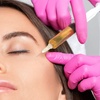 Image 3: Revitalize Your Look with One PRP Hair or Face Injectable  