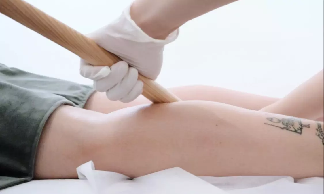 Up to 50% Off on Fat / Cellulite Reduction - Non-Branded at Pinnacle Beauty And Shape Pty Ltd - Primary Image