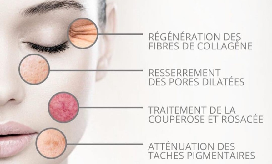 Image 1: 1 ou 3 soins du visage anti-âge de 60 min avec Eleven concept