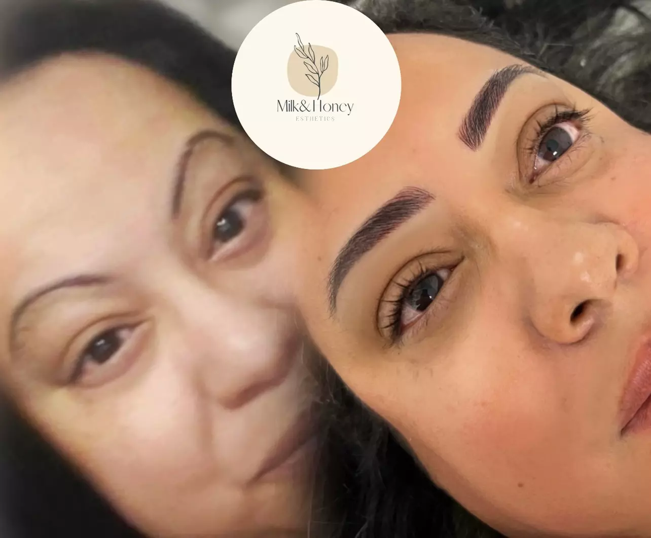 Experience up to 50% off in-office teeth whitening at MILK And HONEY for a brighter, whiter smile and enhanced confidence. - Second Medium
