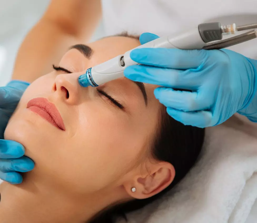 Up to 60% Off on HydraFacial at Beauty Concept Studio - Primary Image