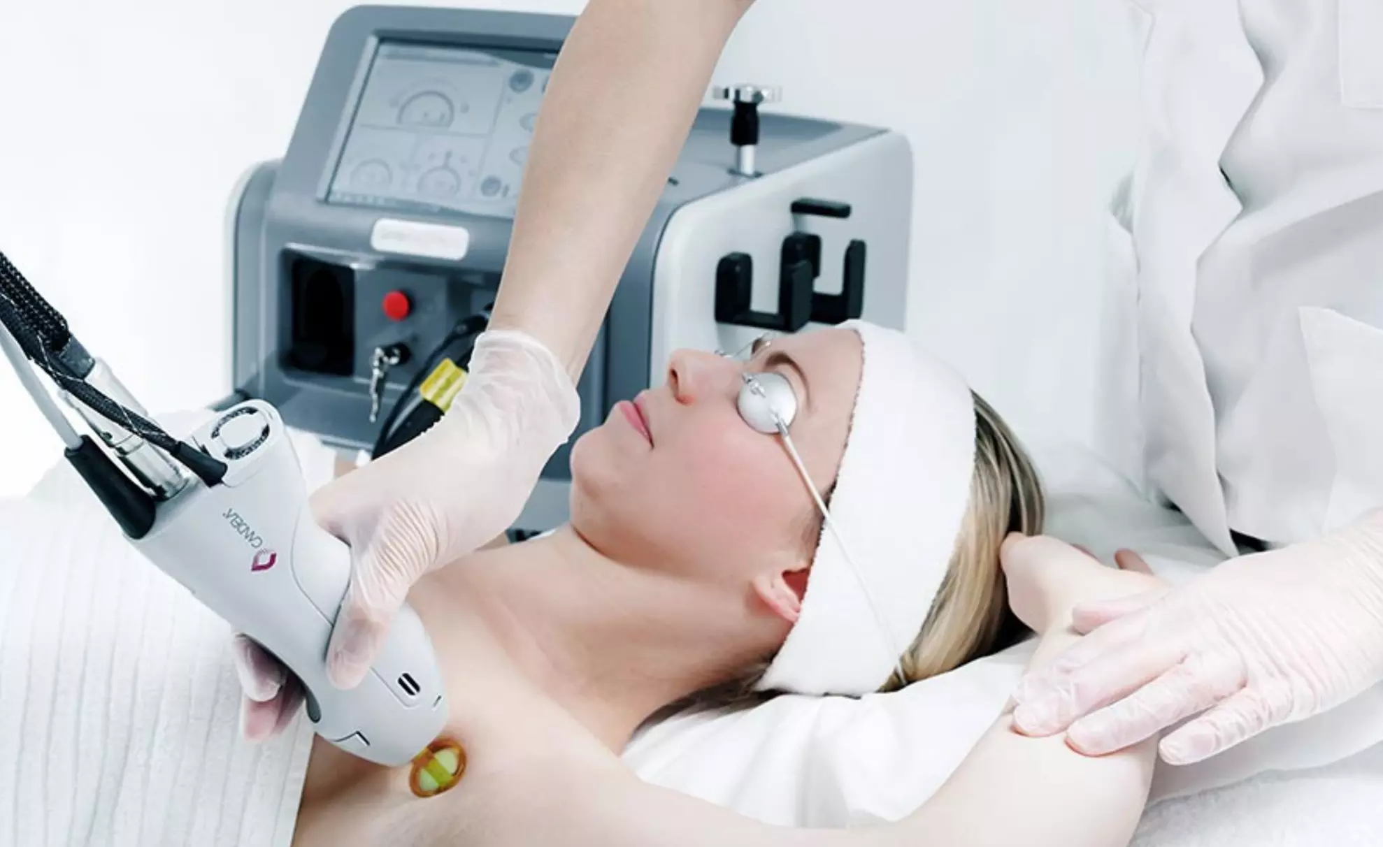 Laser Hair Removal Sessions for Chin, Lip, Neck & More