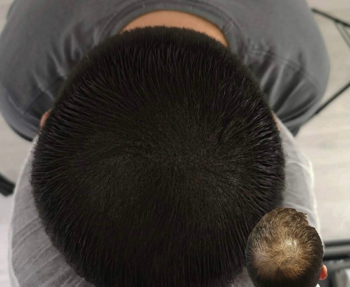 Up to 54% Off on Salon - Scalp Care at Inkheadable